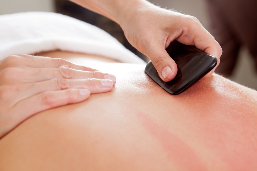 Canva Gua Sha Acupuncture Treatment on Back