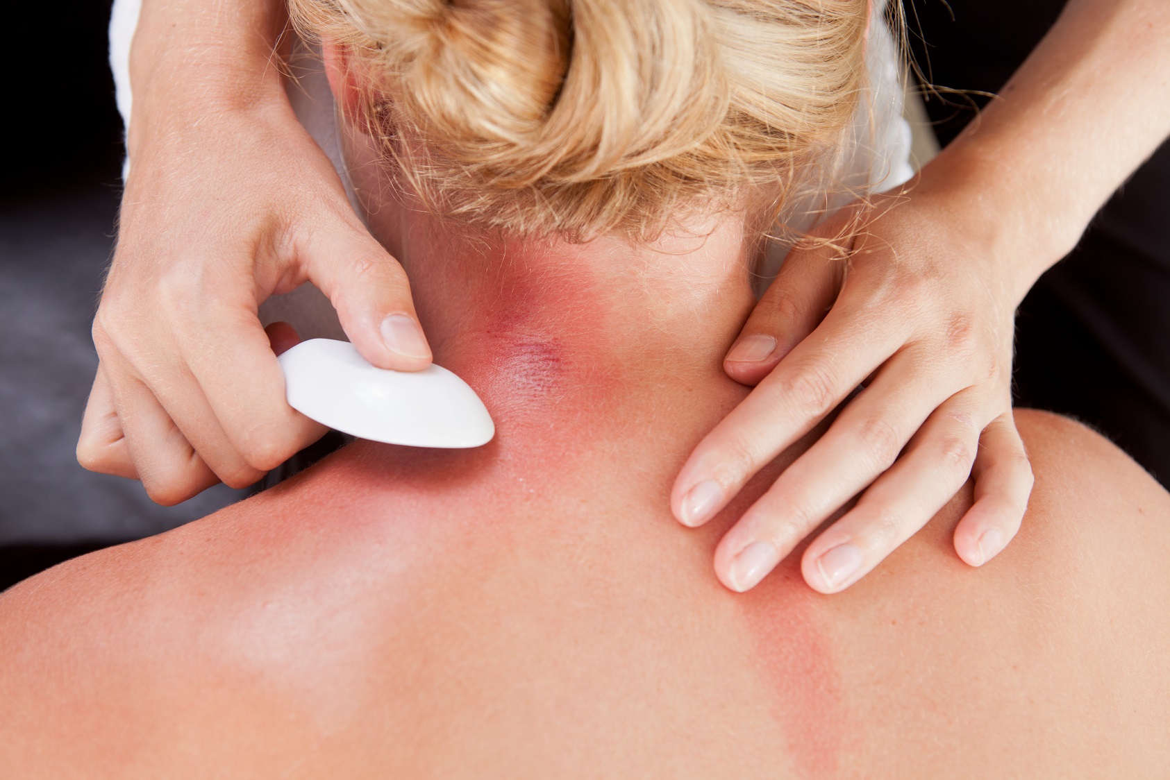 Canva Woman Receiving GuaSha Treatment on Neck